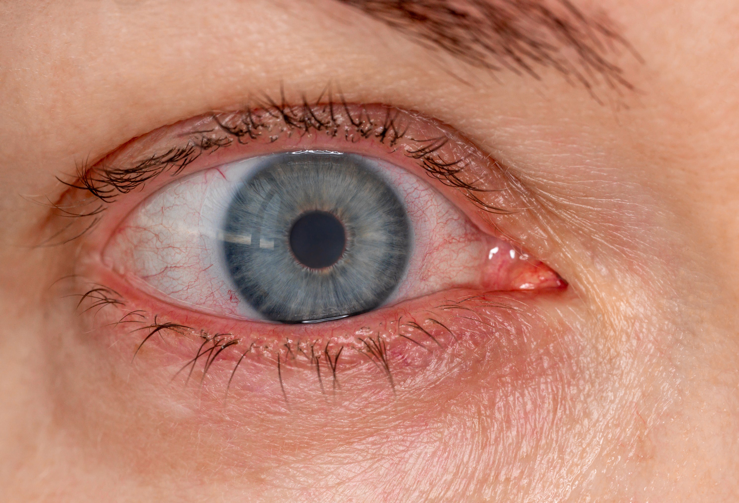 Choosing LUMIFY Over Visine for Red Eyes: A Safer and More Effective Approach